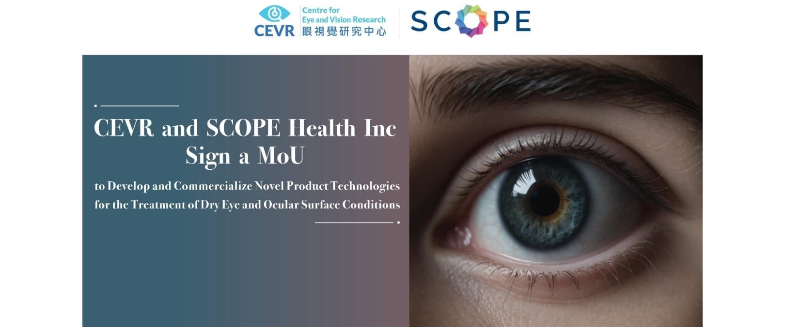 The Centre for Eye and Vision Research (CEVR) and SCOPE Health Inc. logos